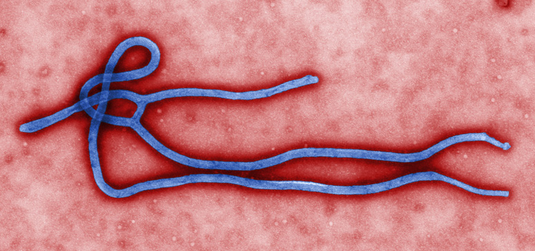 Picture of ebola virus